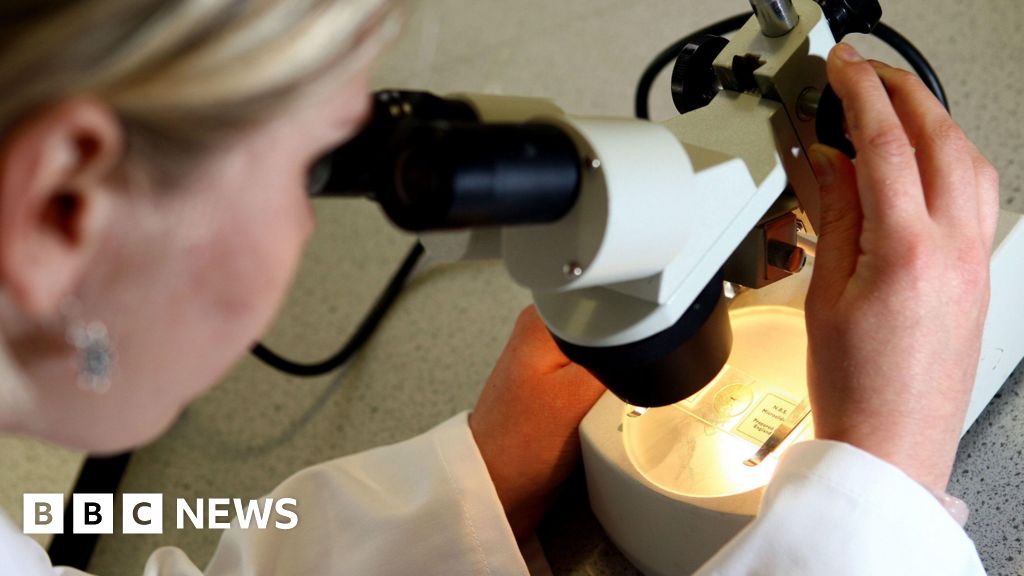 Algorithm study of DNA proves 90% accurate predicting bowel cancer