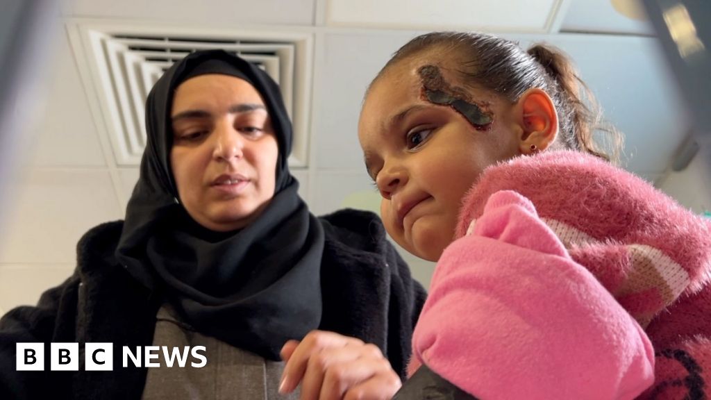 BBC flies with Gazan child to Jordan for life-saving treatment
