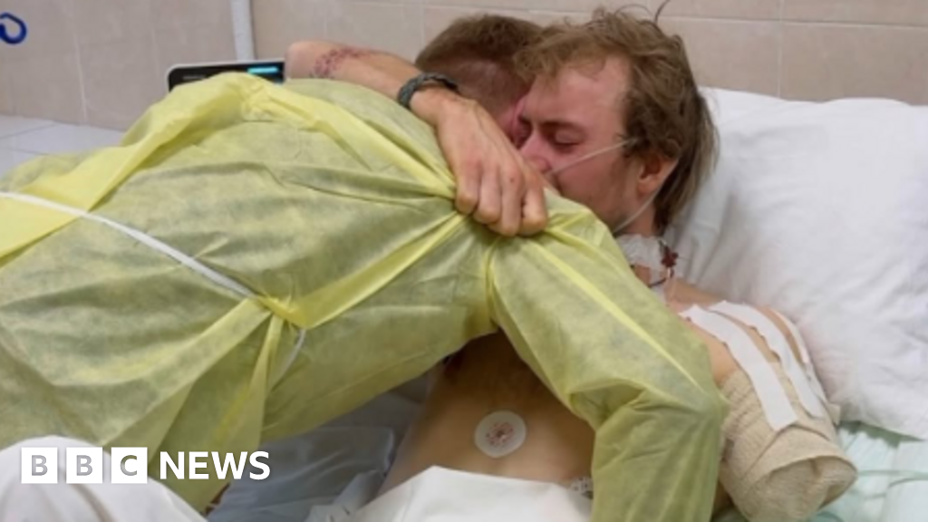 British volunteer medic loses arm and leg in Ukraine strike