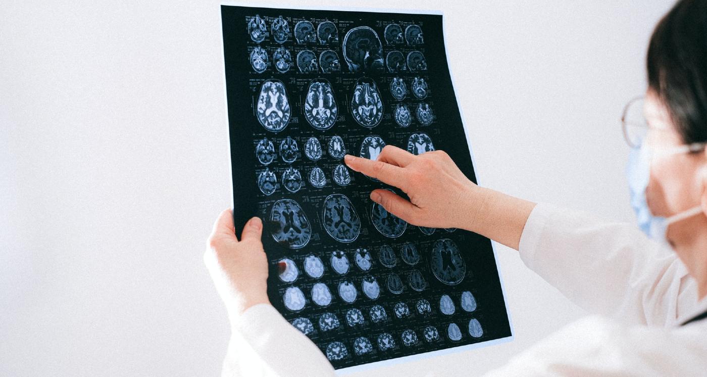 โWe were astonished by the successโ